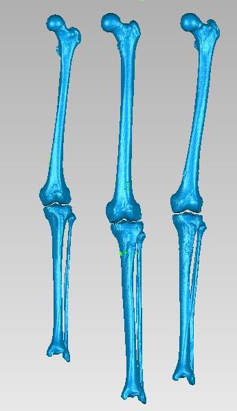 Bony Geometries Three neutrally aligned, nonarthritic, male cadaveric legs Ages: 20,21,