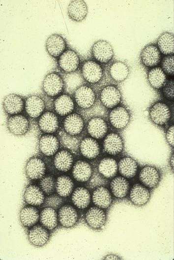 Rotavirus vaccines: Issues not fully