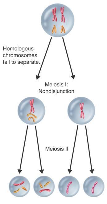 Chromosomal Disorders Nondisjunction Homologous chromosomes