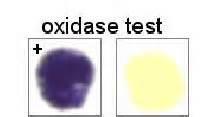 Oxidase test Used to determine the presence of cytochrome c oxidase.