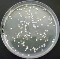 Colony counting on agar plates Count colony numbers after plating a known