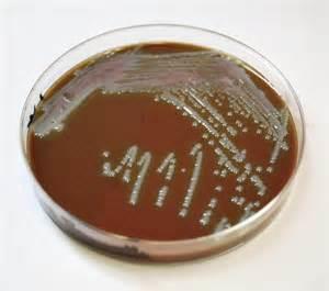 Chocolate agar These are the brown plates (which do not contain chocolate) and are very similar to blood agar.