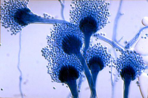 constantly trap and attempt to clear pathogens likes fungi from the airways. Microscopic appearance of Aspergillus fumigatus As mentioned earlier, A.