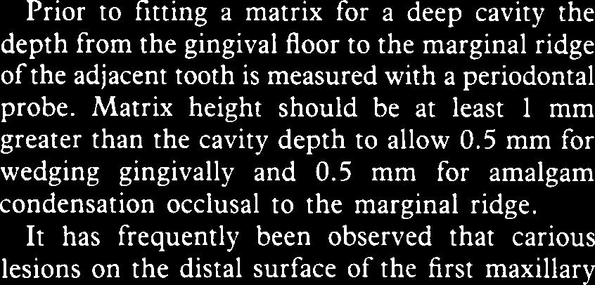 Gaps occur if the wedges are at a steep angle to the gingival outline of the cavity.