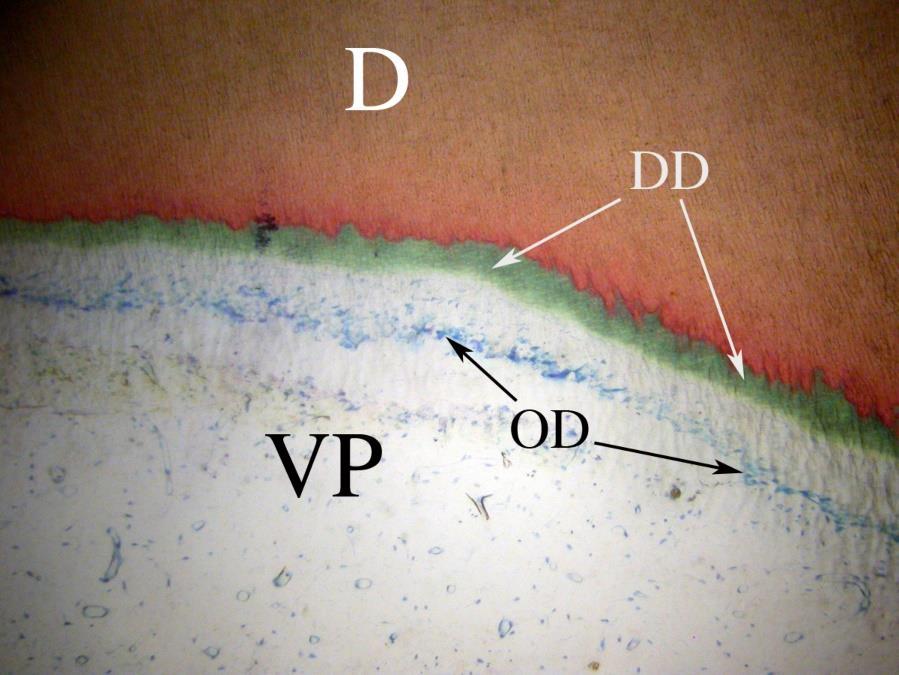 Stevenel s blue and Van Gieson s picro fuchsin X200. Fig. 1B. Seven-day HOTD treated pulp showing dentin (D), vital pulp tissue (VP), odontoblasts (OD), and green-staining dentinoid (DD).