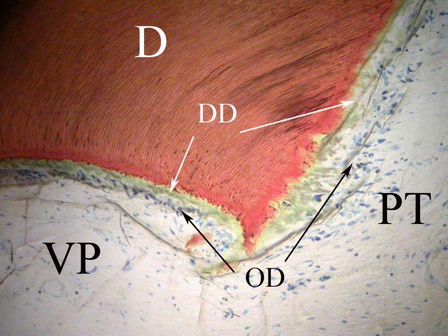 194 (S1) M. D. ROHRER ET AL. Fig. 2B. Twentyone-day Ca(OH)2 treated pulp showing dentin (D), vital pulp tissue (VP), penetration tunnel (PT), odontoblasts (OD), and green-staining dentinoid (DD).