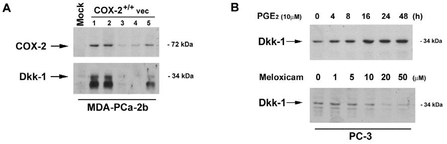 Fig.2. Protein expression of Dkk-1 and sfrp-1 in PCa and MC3T3 preosteoblast cell lines assayed by Western blotting. Cells were lysed and subjected to Western blot analysis.