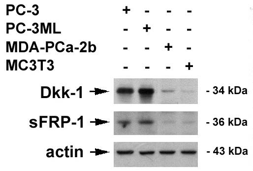 We established several sub-lines of MDA-PCa-2b that stably express COX-2 and examined the expression of the, Dkk-1. As shown in Fig.