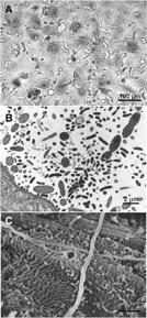 termites Anaerobic Flagellates Prokaryotes in the