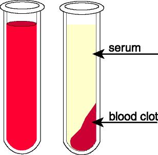 Difference between serum ( 血清 ) and plasma Serum = plasma fibrinogen