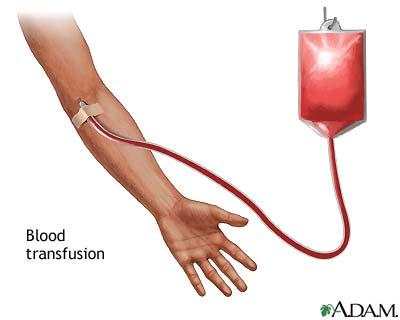 Blood transfusion 输血 To be the process of transferring blood or
