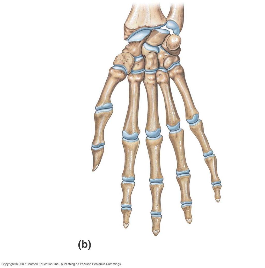 Radius Lunate Scaphoid Pisiform Trapezium Trapezoid Metacarpal bones I II III IV V Triquetrum