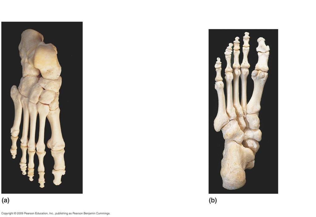 Cuboid Calcaneus Talus Distal phalanx cuneiform Bone (III) Navicular Intermediate (II) cuneiform bone Middle phalanx Proximal phalanx Distal phalanx Proximal phalanx (I) cuneiform bone