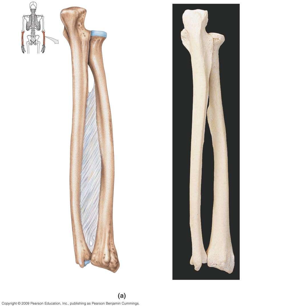 Olecranon Proximal radioulnar joint* Head of radius * Joint puts the radial head into the radial notch of the ulna (not shown) RADIUS ULNA Ulnar notch of