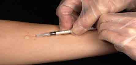 Tuberculin Skin Test Left forearm 2 IU