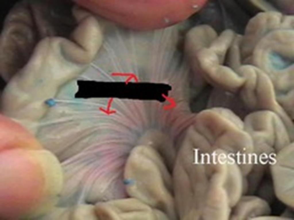 (Slide25) Step 8: Small Intestine It is now necessary to unravel the small intestine a bit.