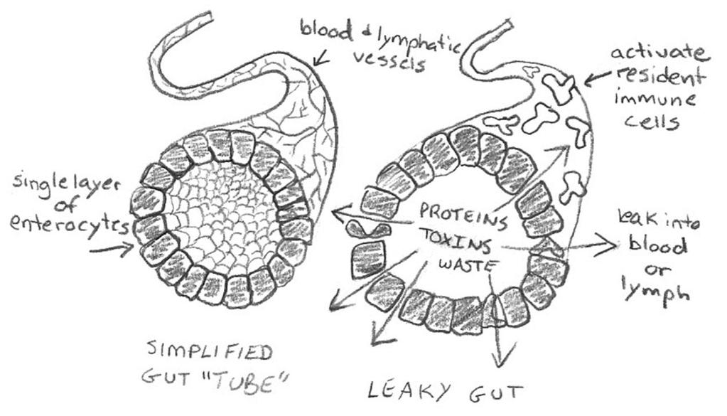 Leaky Gut Is associated with a wide range health problems including allergies, obesity, poor