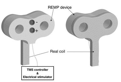 Sham Stimulation Real Electro-magnetic placebo (REMP) Rossi et al.