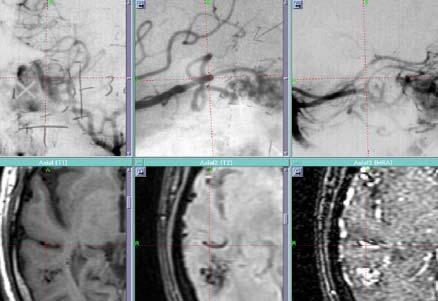 imaging modalities (CT, MRI,