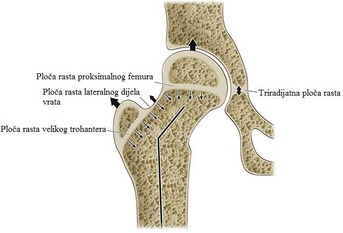 Slika 3. Prikaz ploča rasta femura i triradijatne ploče rasta. Preuzeto i modificirano sa: http://musculoskeletalkey.com/normal-hip-embryology-and-development/ 1.