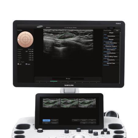 INTELLIGENT DIAGNOSTIC TOOLS ADVANCED TECHNOLOGY FOR CONFIDENT DIAGNOSIS RS80A increases confidence with accurate results using advanced technologies developed by Samsung, while