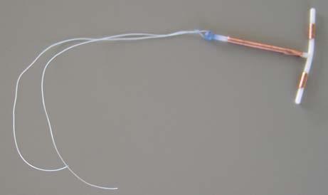 Copper IUD (ParaGard) Effective for 10 years