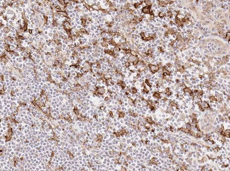 PD-L1 and PD-L2 Immunohistochemistry 16 samples were