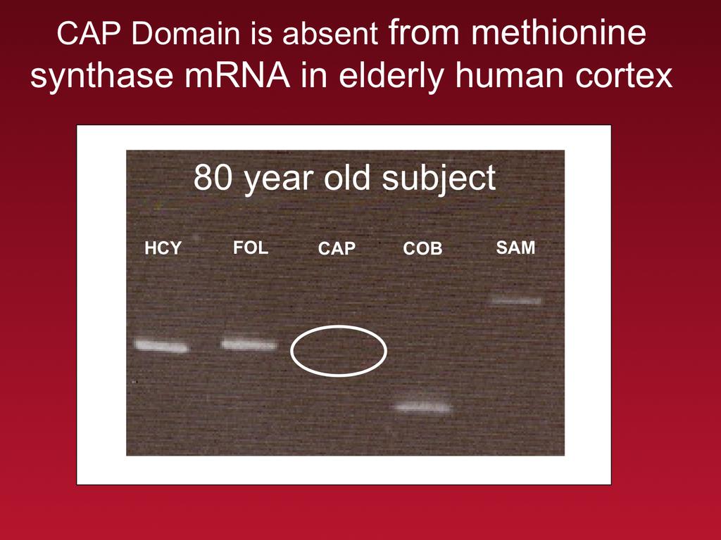 However, PCR analysis of methionine synthase mrna from postmortem human cortex from