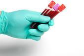 functional decline Considerations Obtaining blood cultures is not recommended