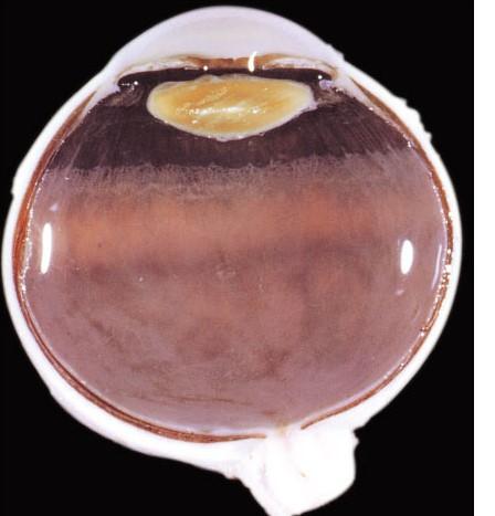45 46 Retina (sensory tunic) Pigmented epithelial