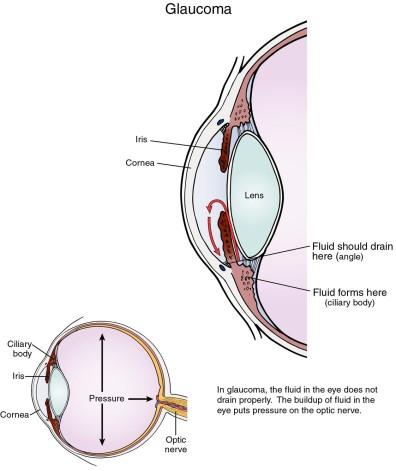 Draw and label a cross section of the eye Be sure to include the following structures: 53 Fibrous tunic Vascular tunic Retina Cornea Sclera Choroid Ciliary body Ciliary muscle Ciliary processes