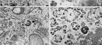 Varicella-zoster virus The smallest of the herpesviruses 125,000 base pairs 70 Open reading frames (ORFs) Receptors: heparan sulfate, mannose-6 phosphate receptor