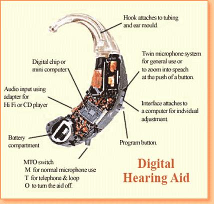 Digital Block Diagram Hearing Aid Components Basic Microphone Amplifier (Digital Signal Processor) Receiver Battery Additional Volume control Telecoil (t-coil) Multiple memories Direct audio input