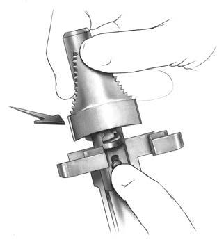 aligning with the impactor handle. The broach has a built-in stop so it cannot be overimpacted (Figure 156).