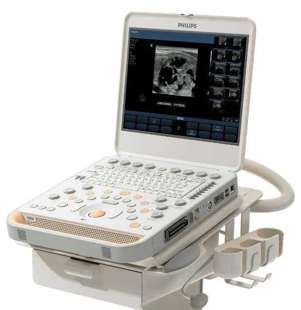 compact ultrasound system. While doing portable studies I can t always count on the performance of my smaller, compact ultrasound system.