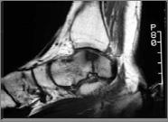 The Difficult Ankle Investigation