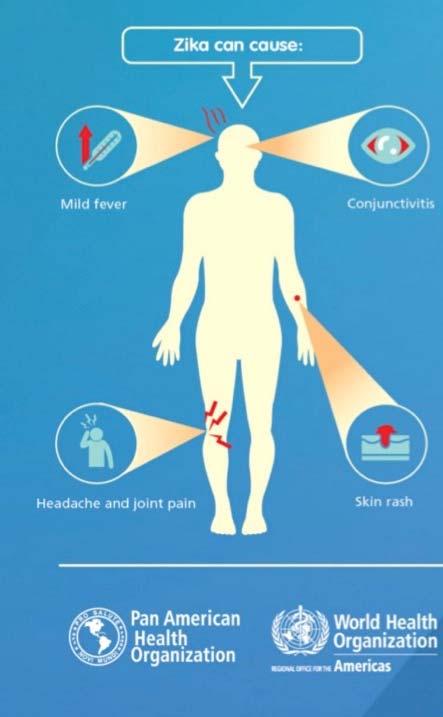 Symptoms The symptoms of the disease can include: Fever Joint pain Rash Conjunctivitis Muscle Pain Headache Four out of five infected