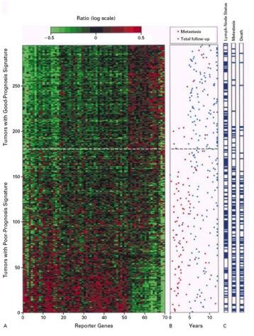 Gene Expression Profile RoPerdam Study 70- Gene Profile Prognos5c in both node nega5ve (n=151) and node posi5ve (N = 144) Validated in mul5- ins5tu5on study