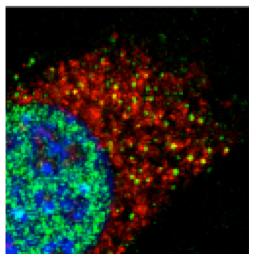 Nuclei were stained with DAPI and right panels reflect higher magnification of boxed areas to