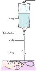 Administration sets IV fluid bag Drip chamber Roller clamp Administration port Administration sets Drip chamber Compartment immediately below IV bag where IV fluid drips at predetermined volume Can