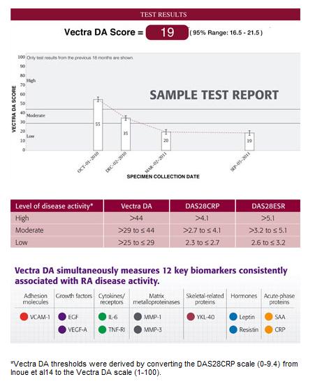 Vectra testing: disease activity measure 12 biomarkers, including CRP, IL-6, serum amyloid A (largest contributors to score) Vectra scores