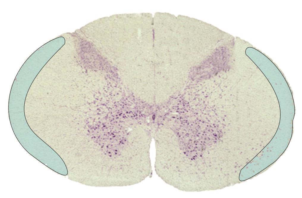 Spinocerebellar Pathway The spinocerebellar tracts are in the lateral funiculus of