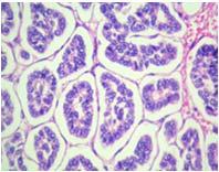 Histological Growth Patterns