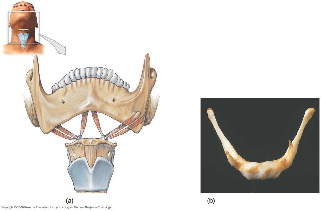 Mandible and hyoid s Styloid (temporal ) Greater horn Lesser horn Thyroid cartilage