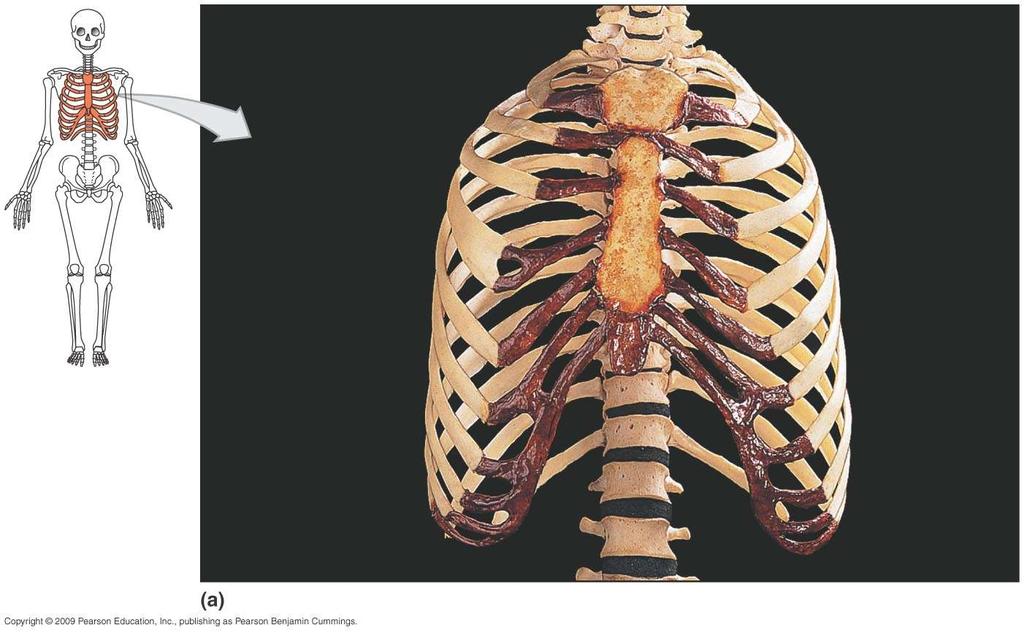 Thoracic cage- ribs (costae), sternum, and vertebrae Jugular notch Manubrium 2 Sternum Body Xiphoid 3 4 True ribs (ribs 7)