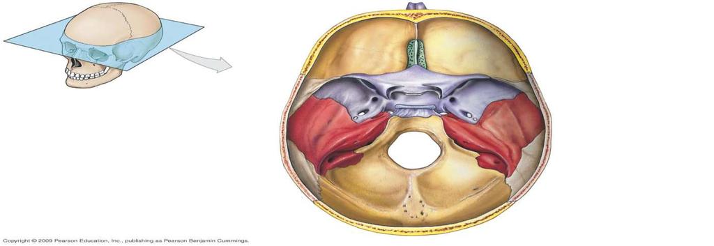 Frontal Ethmoid Sphenoid Temporal Carotid canal (temporal ) Parietal Occipital Foramen magnum Crista galli (ethmoid ) Cribriform plate Ethmoid ) Sella
