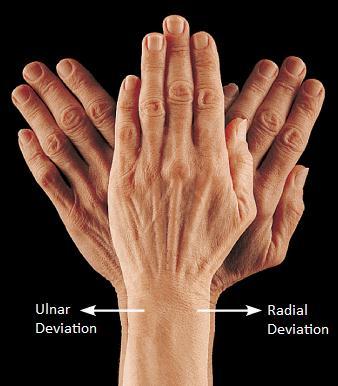 Movements of the Wrist & Thumb Radial Deviation Movement of