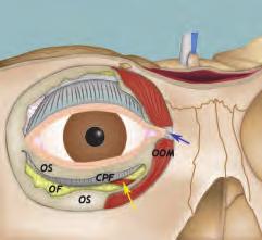 Anatomical Background 15 A B C Fig. 3.9 Three-dimensional reconstruction of the superior orbital fissure (A). Lateral (B) and medial (C) endoscopic views.
