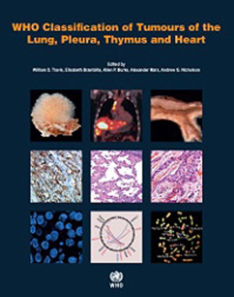 WHO Classification of Tumours of the Lung, Pleura, Thymus and Heart.