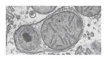 Lysosomes are digestive compartments within a cell destroy bacteria that have been ingested Recycle damaged organelles Rough ER Plasma membrane Transport vesicle